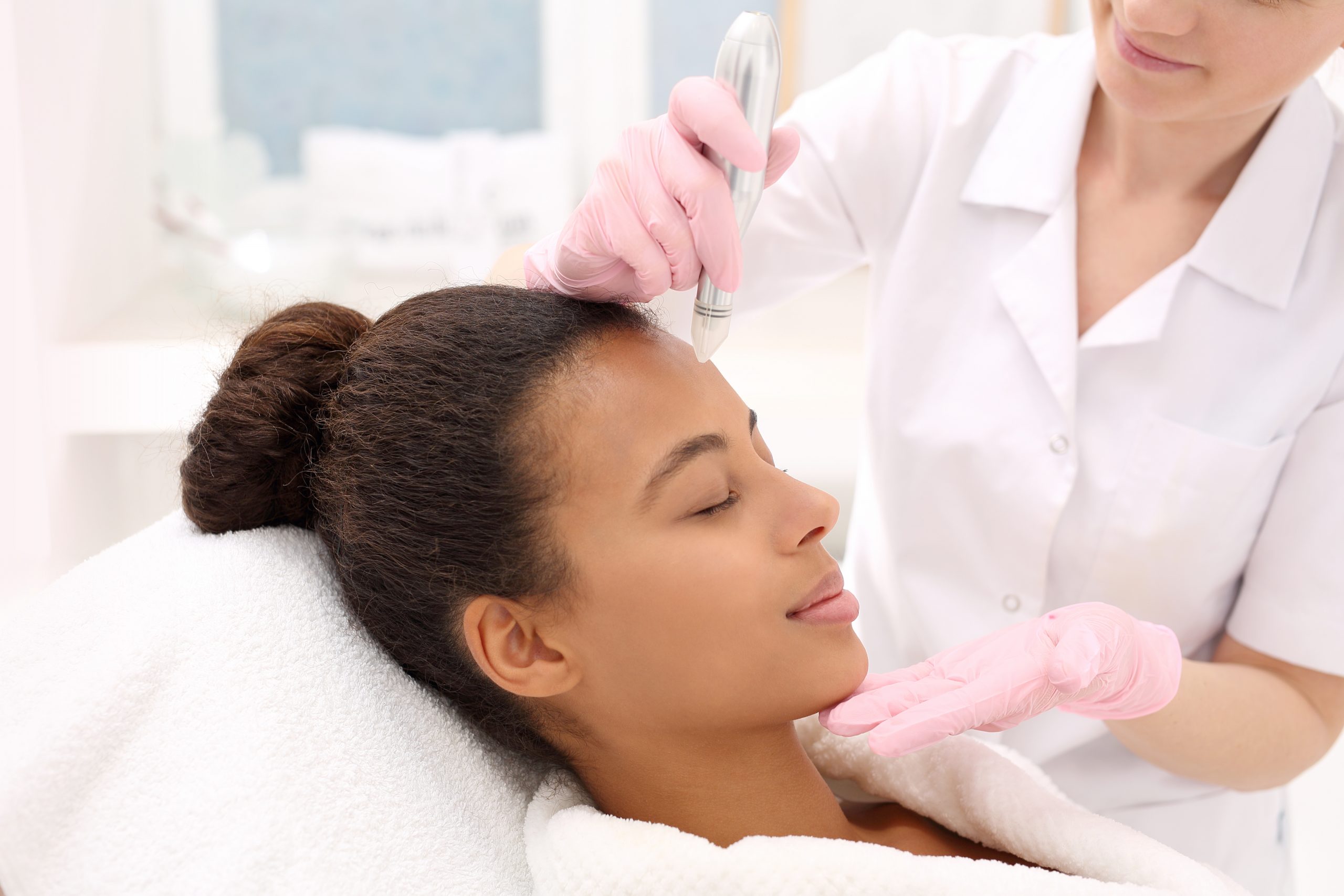 Microneedling with PRP in Seattle, Bellevue and Kirkland