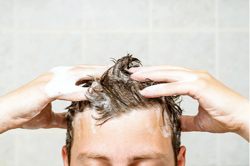 A Photo For A Blog Post About After PRP Hair Restoration