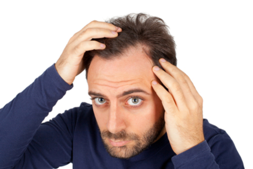 A Photo For A Blog Post About What Is The Best Hair Restoration Method?