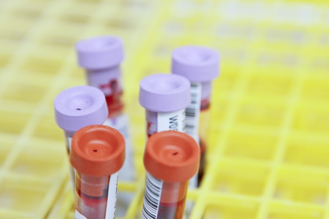 What Does Platelet Rich Plasma Do In The Body?