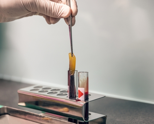A Photo For A Blog Post About Benefits Of Platelet Rich Fibrin