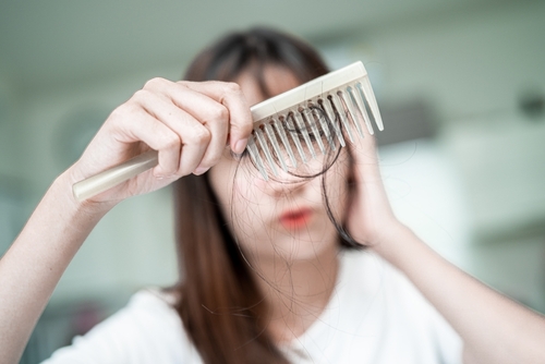 Does PRP Work For Female Hair Loss?