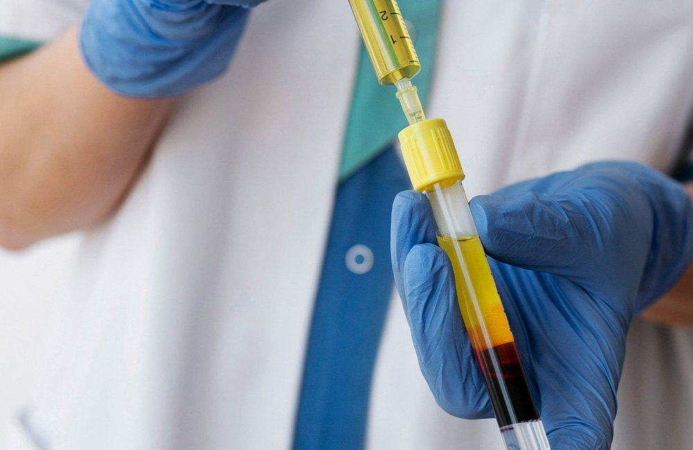 Choosing the Best Blood Collection Tubes for PRP: A Comprehensive Guide