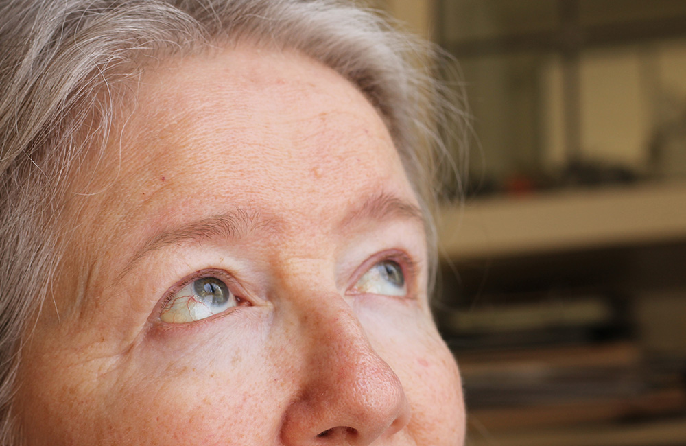 How Long Does Swelling Last After PRP Under Eyes?
