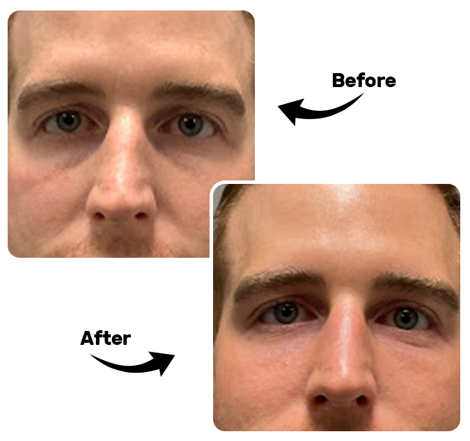 Before After