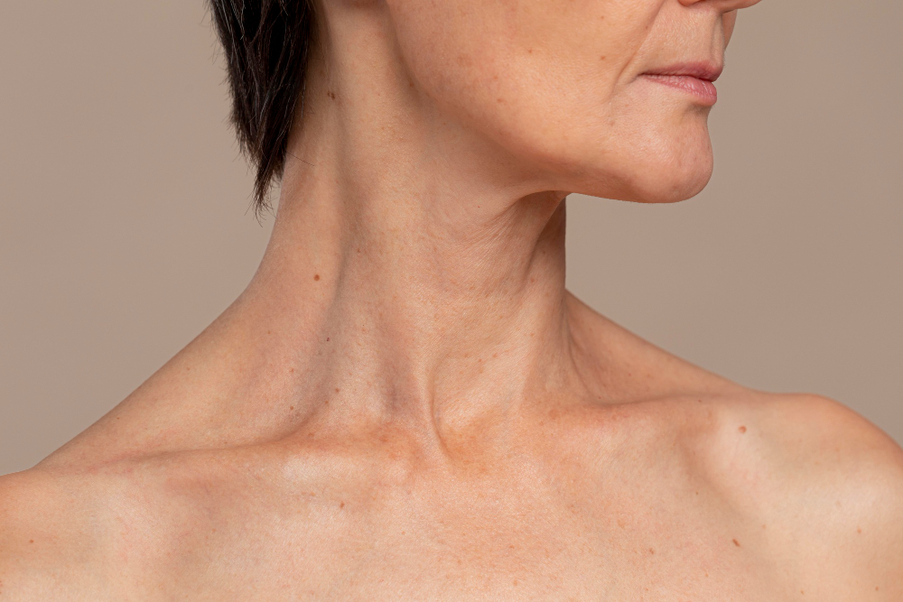 tighten neck skin with PRP