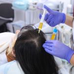 What to Expect Before, During, and After Your PRP Treatment