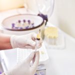 What Conditions Can PRP Injections Treat Effectively?