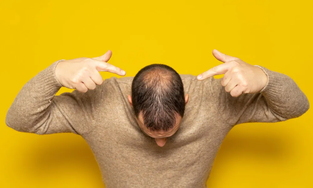 Who Is a Good Candidate for PRP Crown Treatment? Who Is a Good Candidate for PRP Crown Treatment?