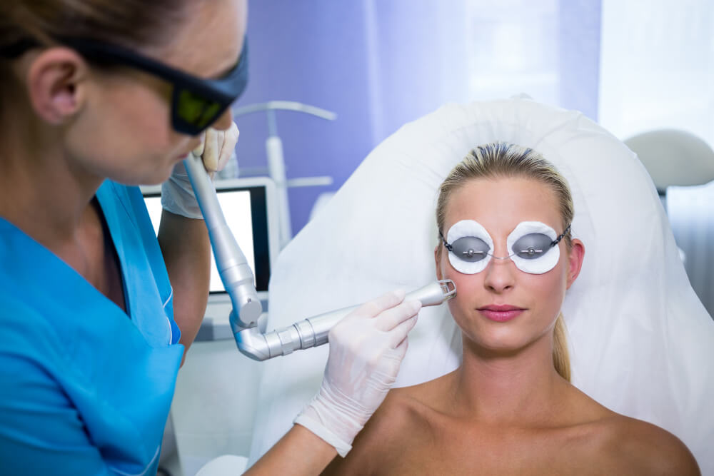 Acne Scars-co2-laser (3)