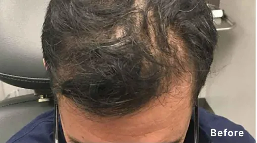 before-01 before-01