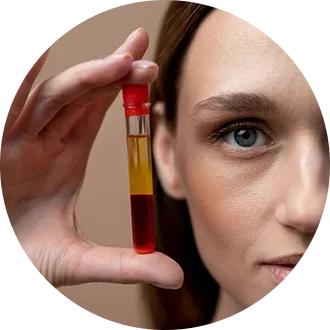 prp-injections