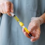 Exosomes vs PRP Hair Restoration Seattle