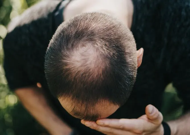 What is Crown Thinning?