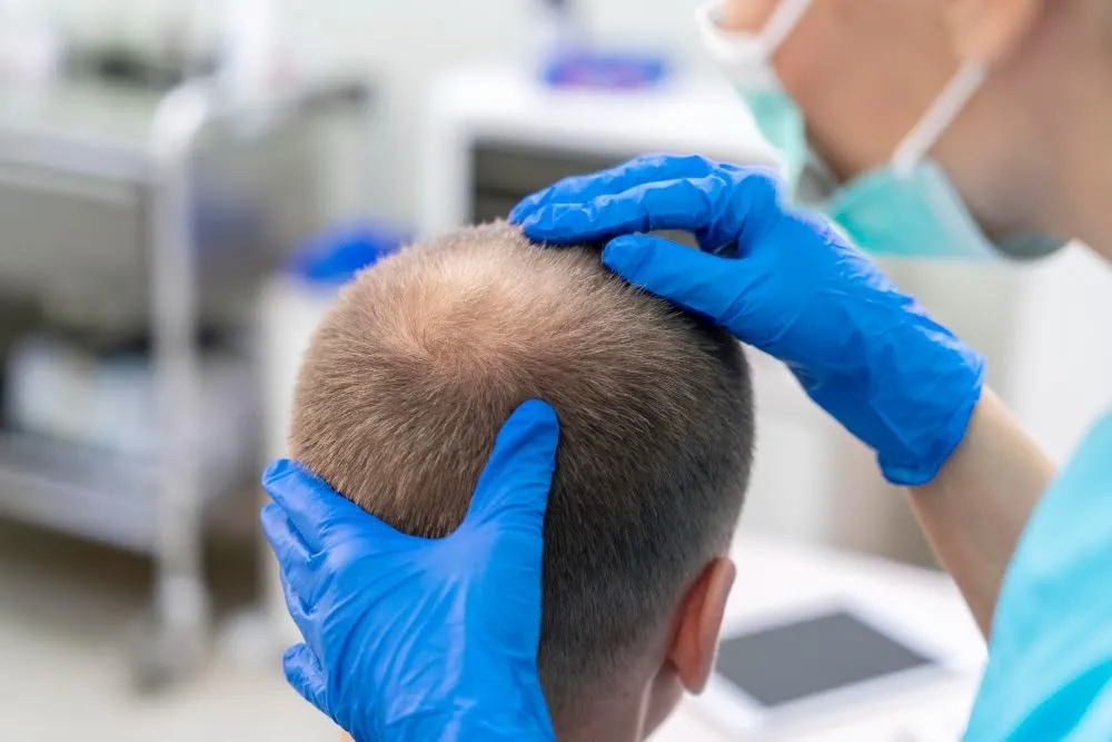 Hair-Loss-Treatment-02 What Causes Hair Loss?