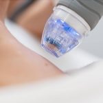 Can RF Microneedling With PRP Tighten Skin in Seattle?