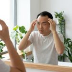 Why Is My Hairline Receding in My 20s and 30s?