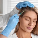 Can PRP Help with Hair Thinning? Discover Hair Restoration in Seattle