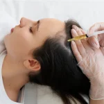 What to Expect During a PRP Hair Restoration Session